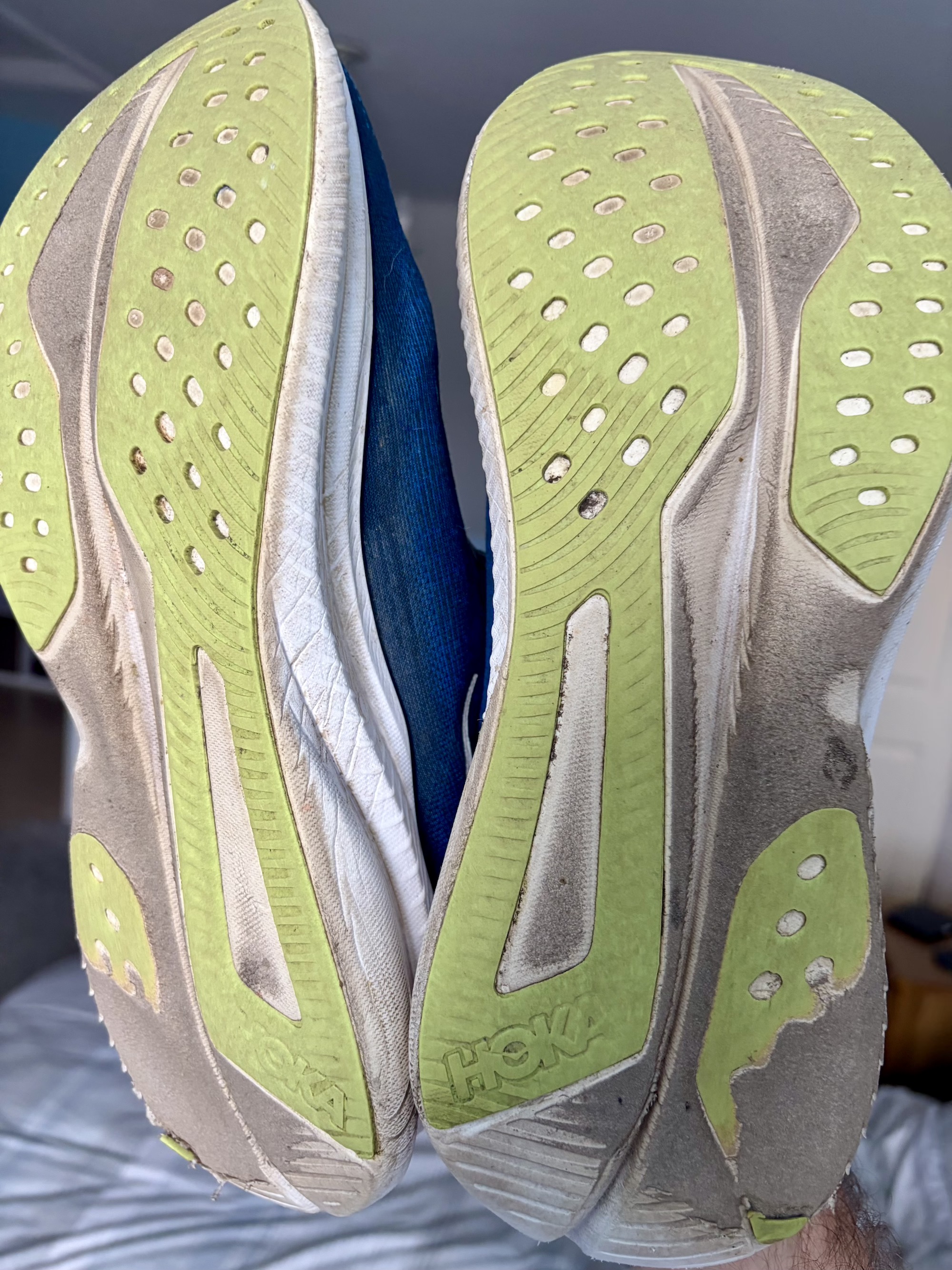 The Anatomy of a Dead Midsole: When Is It Time to Retire Your Running Shoes?